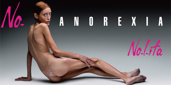 거식증으로 2010년에 사망한 프랑스 모델 이사벨 카로. 그는 생전에 거식증의 위험성을 알리는 캠페인에 동참했다. 포스터에 ‘No, 거식증’이라고 돼 있다. 프랑스는 지난해 마른 모델을 퇴출하는 법안을 통과시켰다. ⓒphoto 뉴시스
