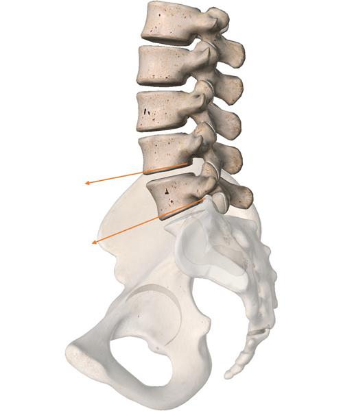 허리를 과신전했을 때 척추기립근이 허리뼈를 뒤로 당기게 되는데, 이 힘은 동시에 아래 허리뼈는 앞쪽으로 밀어낸다. ⓒphoto. 이우제
