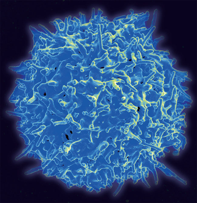 T세포 이미지 ⓒphoto 위키피디아