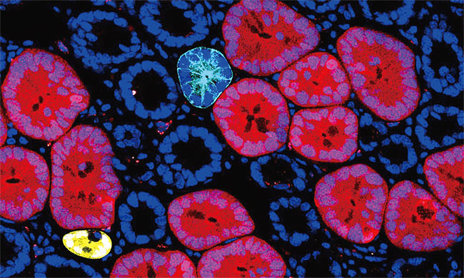 영국 케임브리지대 거든연구소와 오스트리아 분자생명공학연구소 팀이 생쥐를 모델로 개발한 레드투온코(Red2Onco) 시스템. 암세포와 정상세포를 다른 색깔로 표지한 후 두 세포를 추적할 수 있도록 했다. ⓒphoto Scitechdaily.com