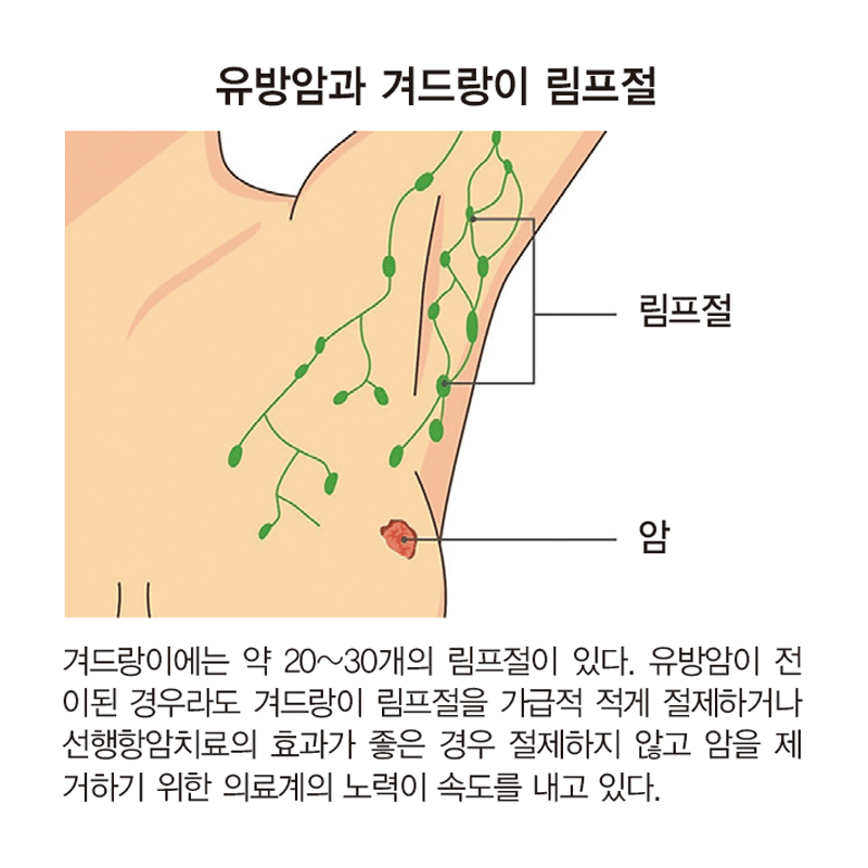 유방암이 재발하는 이유는 무엇입니까? 4