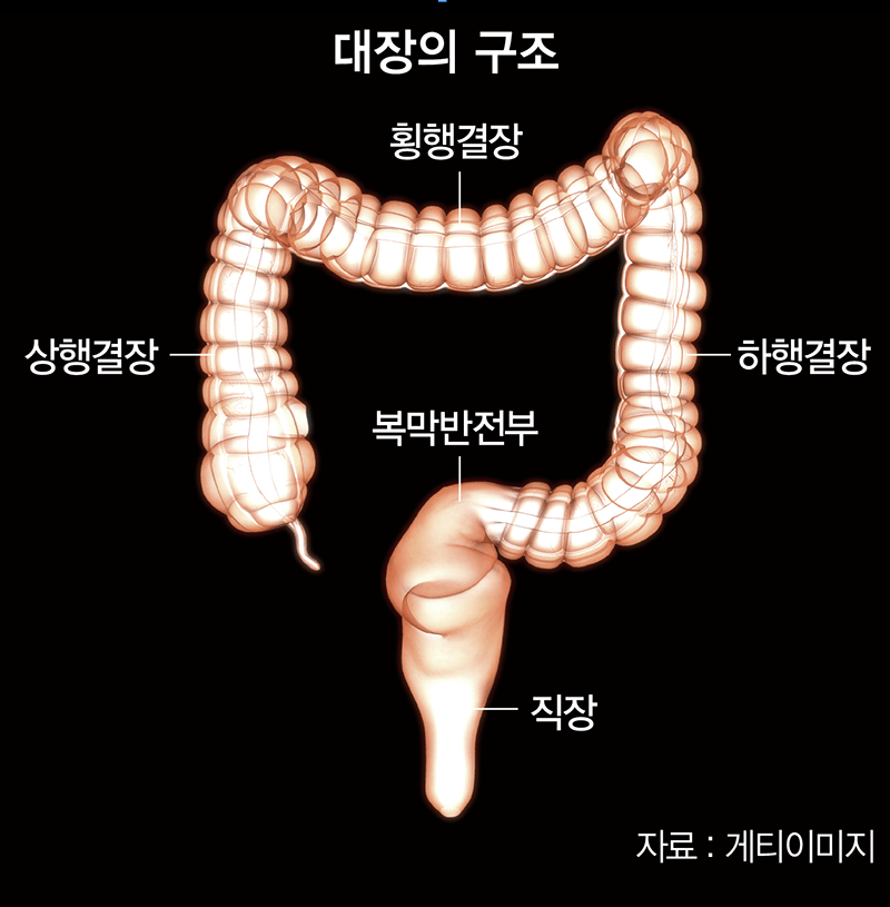 [新명의 열전] “젊은 대장암이 위험하다” 김진 교수의 경고
