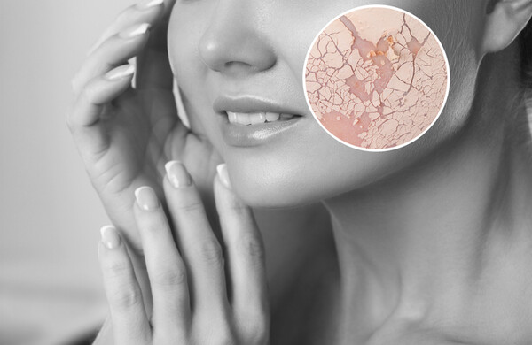 photo 게티이미지코리아