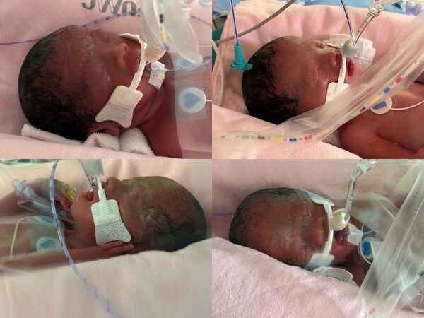 네 쌍둥이 출산 소식을 알린 A씨가 올린 사진. photo 온라인 커뮤니티 캡처